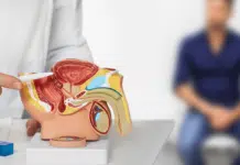 Un médecin expliquant le cancer de la prostate