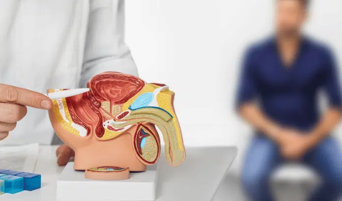 Un médecin expliquant le cancer de la prostate